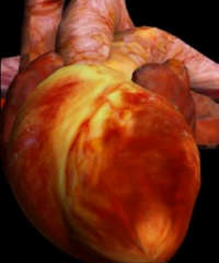 Damaged Heart